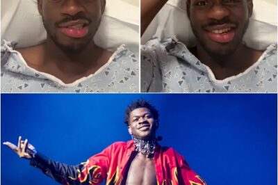 Fans Stunned After Lil Nas X Reveals What’s Really Happening to His Face